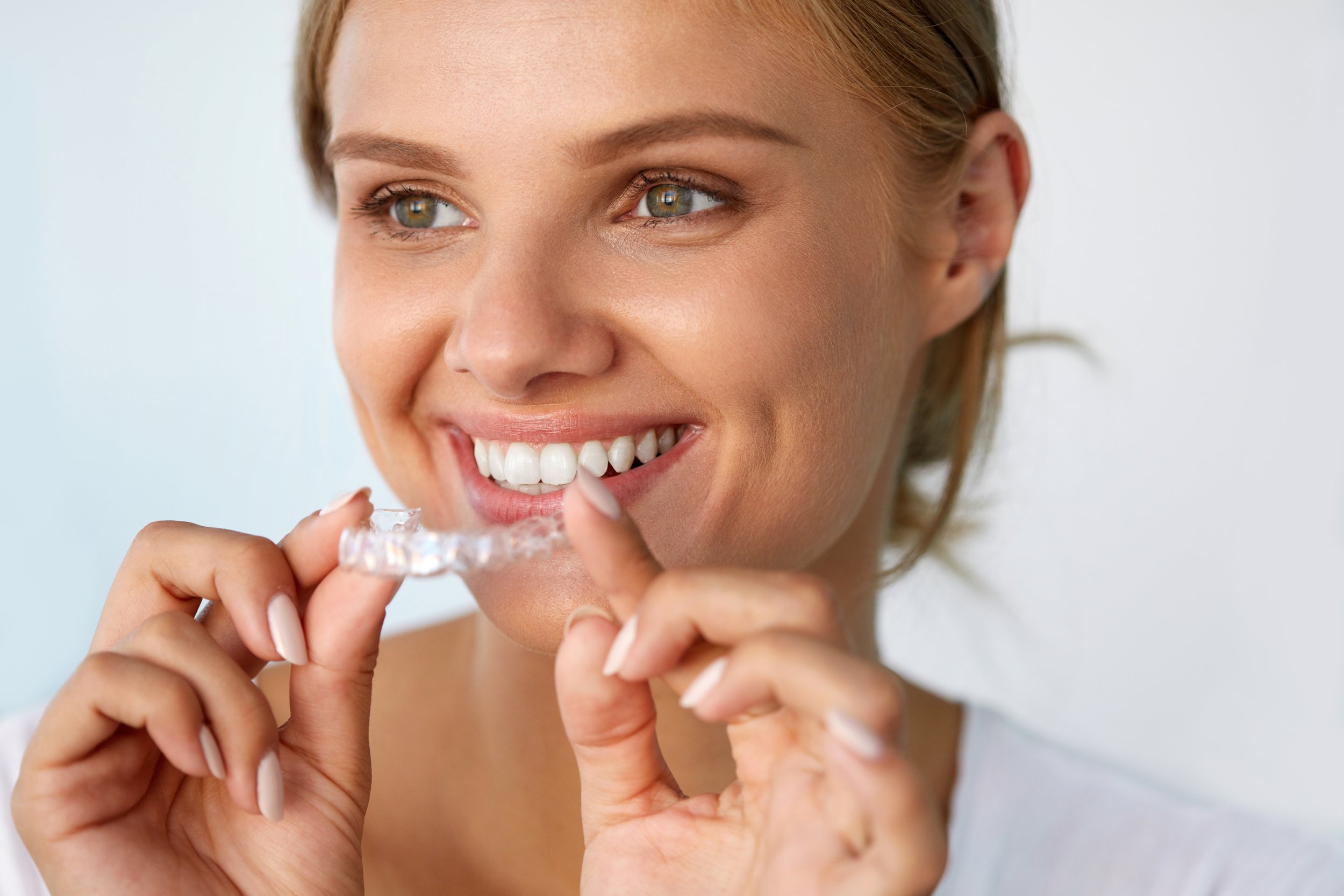 clear aligners fort lauderdale